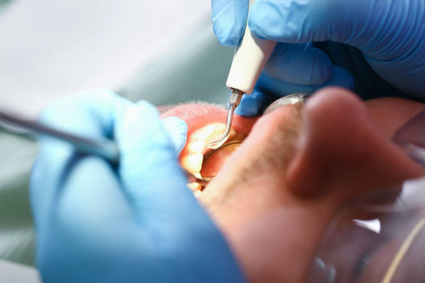 Best Emergency Cosmetic Dentistry in Scottville, MI